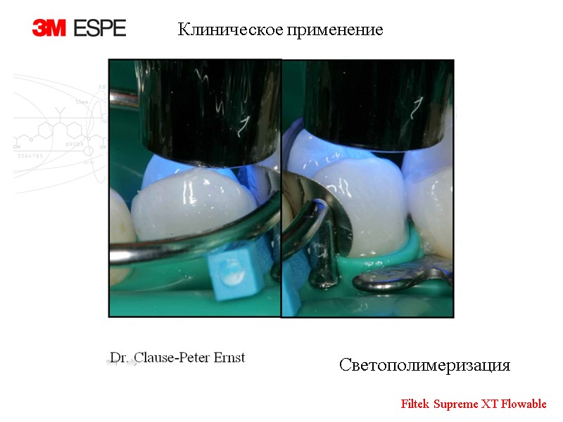 Светополимеризация Клиническое применение